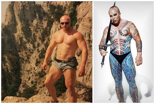до и после пластики